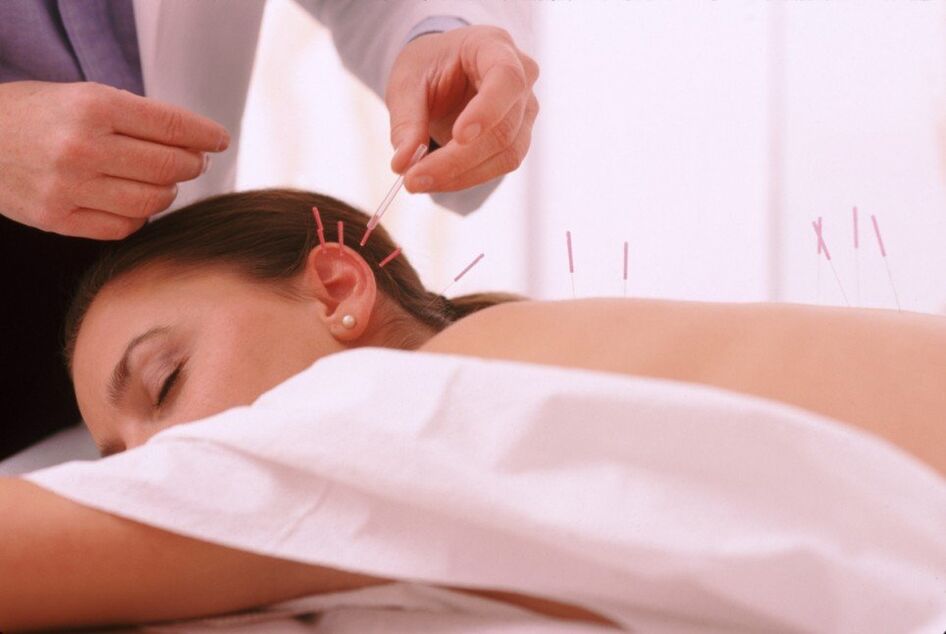 Acupuncture and acupuncture cervix with osteoporosis